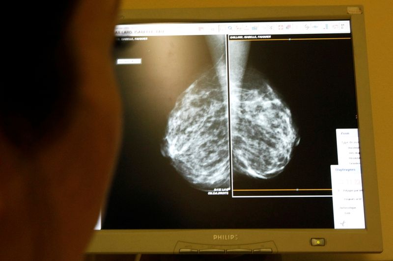 Earlier breast cancer screening would narrow mortality gap for Black women, U.S. study finds