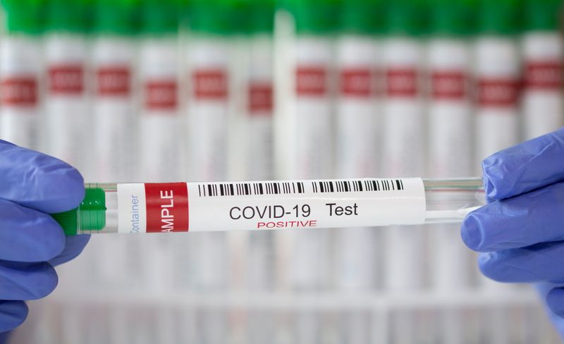 Quest Diagnostics profit falls 11% on slow demand for non-COVID testing