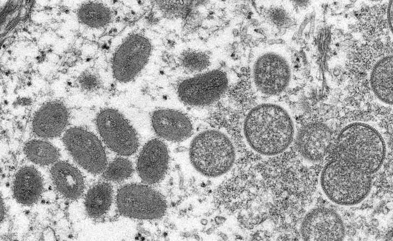 Explainer-Why monkeypox cases are spreading in Europe, US