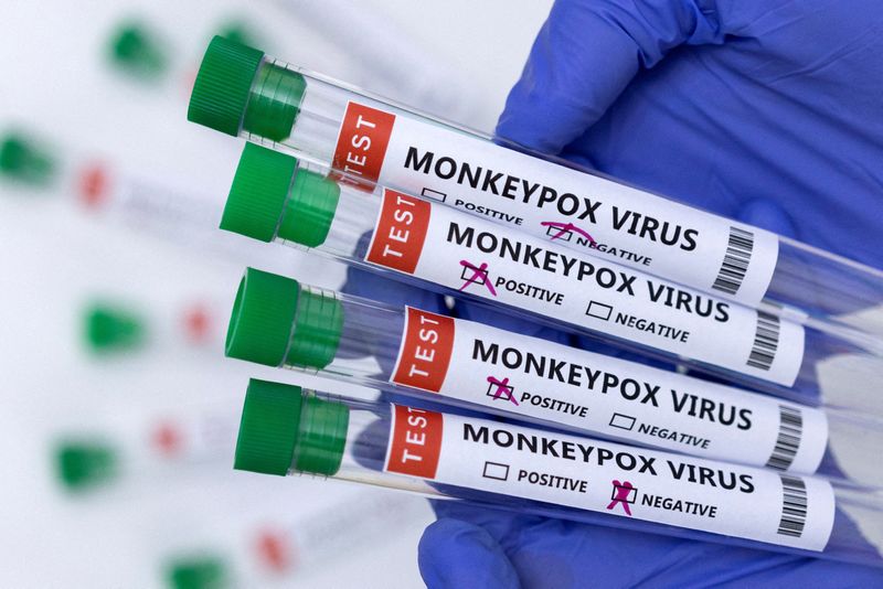 U.S. confirms nine monkeypox cases in seven states